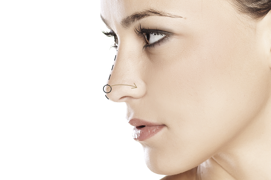 ¿Cómo perfilar tu nariz sin necesidad de cirugía?
