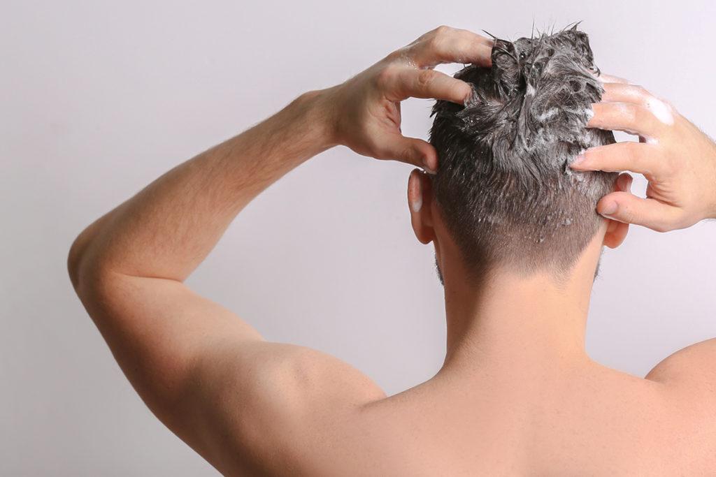 un hombre se lava la cabeza después de un injerto capilar